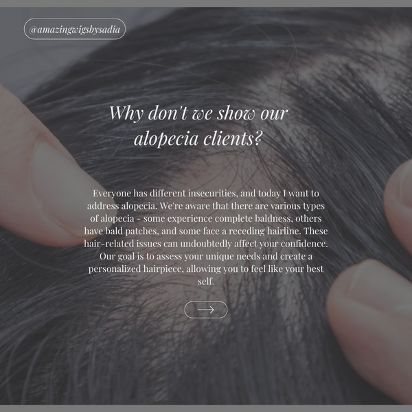 Why don't we show our alopecia clients